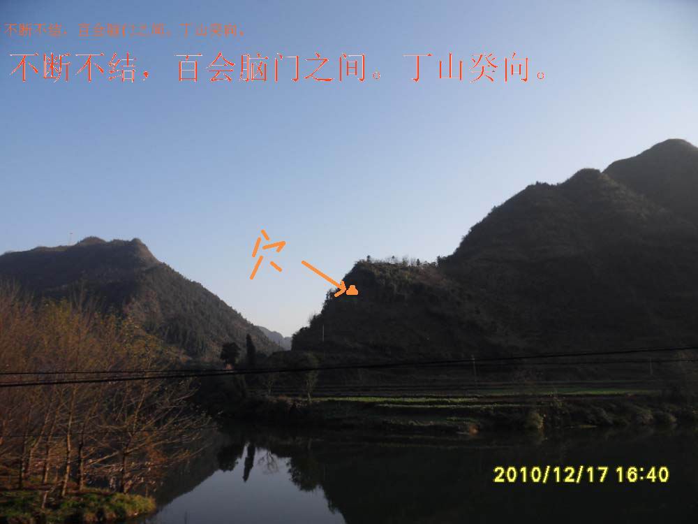 百会穴.jpg