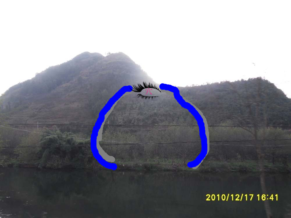 穴位.jpg